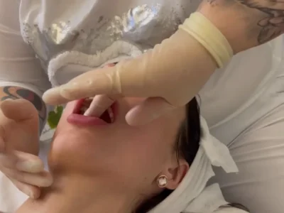 Букальний (інтраоральний) масаж